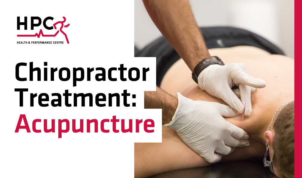 HPC Chiropractic Acupuncture. Man getting a chiropractic acupuncture 