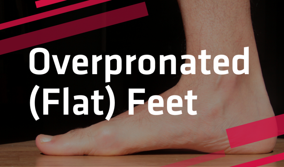 Overpronated (Flat) Feet