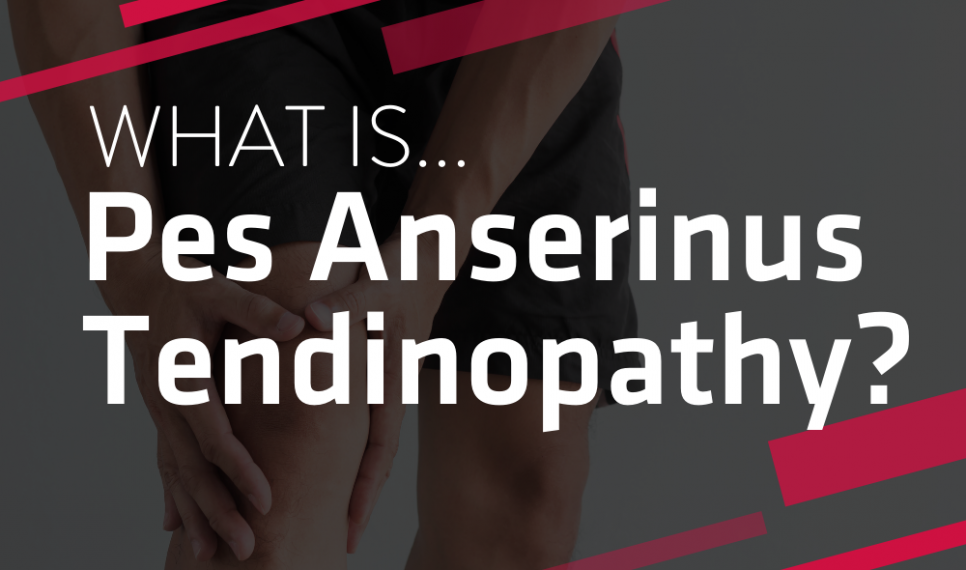 Pes Anserinus Tendinopathy Guelph Physiotherapy