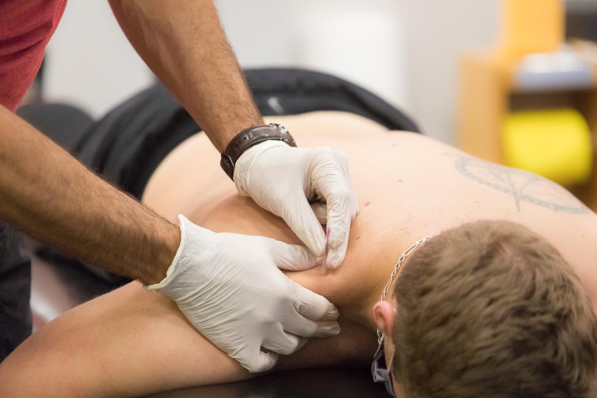 Physiotherapy Guelph dry needling