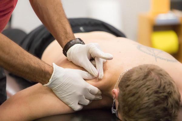 Guelph Chiropractor providing Acupuncture treatment to male patient for neck and shoulder pain at the University of Guelph Health and Performance Centre (HPC)