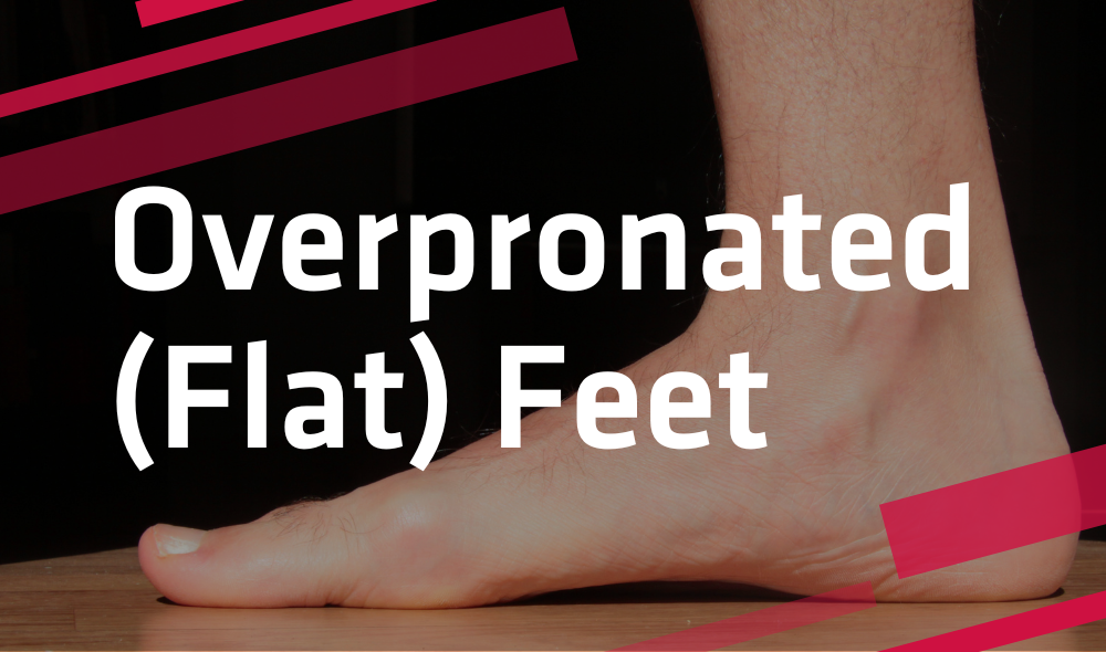 Correcting Overpronated (Flat) Feet | Student Wellness