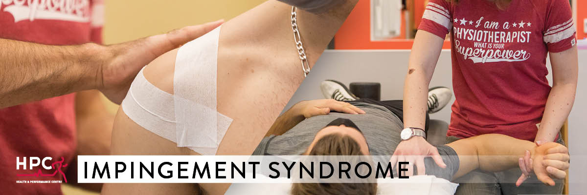impingement syndrome